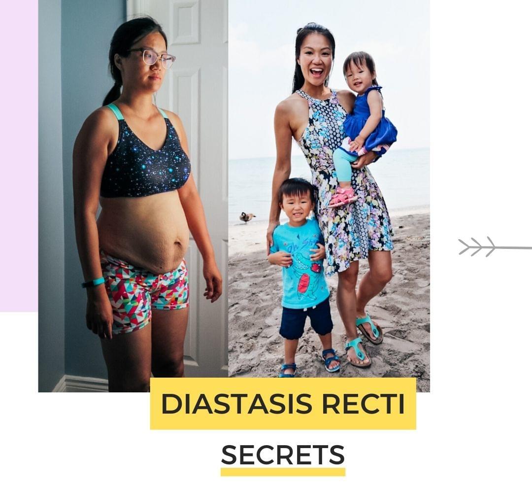 diastasis recti secrets becky choi